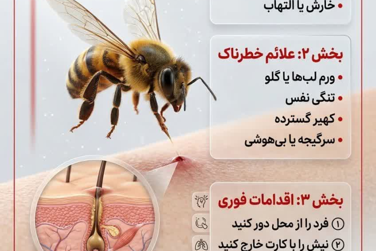  وقتی زنبور نیش می‌زند، دقیقاً چه کار کنیم